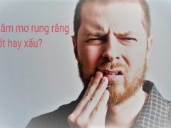 Giấc mơ gãy răng chảy máu là giấc mơ nhiều người gặp phải